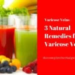 3 Natural Remedies for Varicose Veins