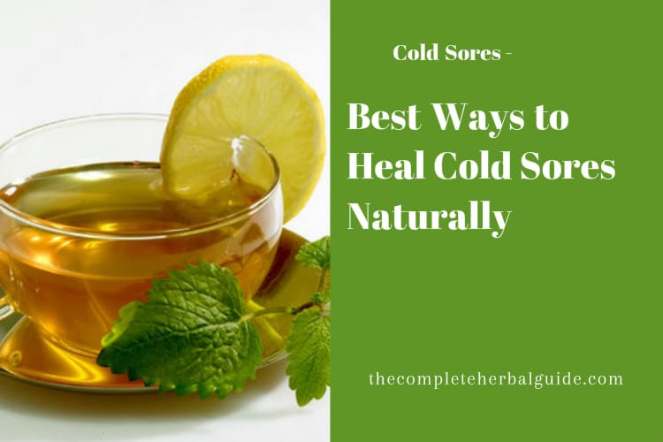 Best Ways to Heal Cold Sores Naturally