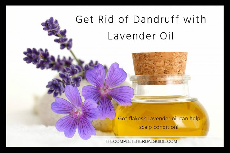 Got flakes? "Lavender oil can help scalp condition