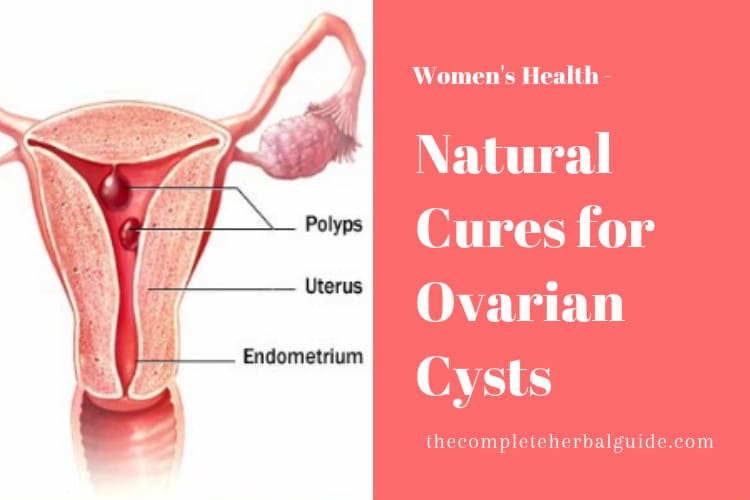 Natural Cures for Ovarian Cysts