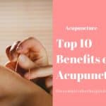Top 10 Benefits of Acupuncture