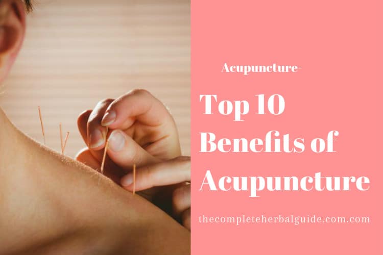 Top 10 Benefits of Acupuncture