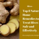 Top 8 Natural Home Remedies to Treat Hives Safe and Effectively