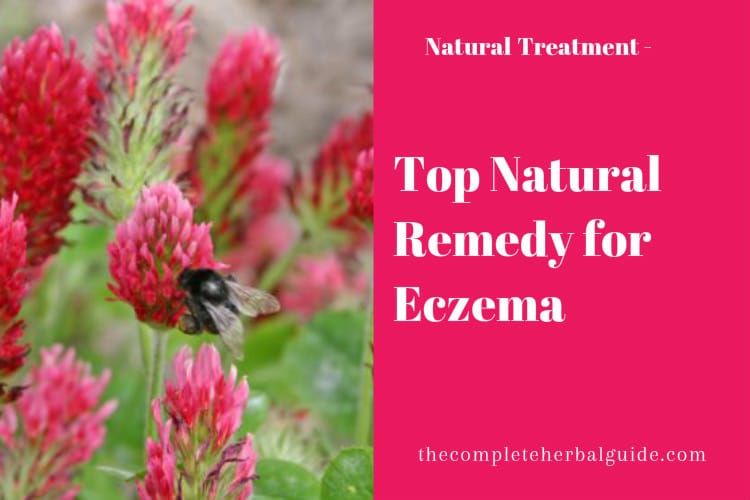 Top Natural Remedy for Eczema