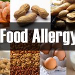food-allergy