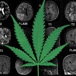 marijuana-epilepsy