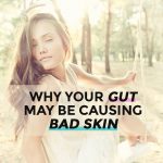 Acne Can Start In Your Gut