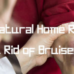 Top-20-Natural-Home-Remedies-to-Get-Rid-of-Bruises-Fast