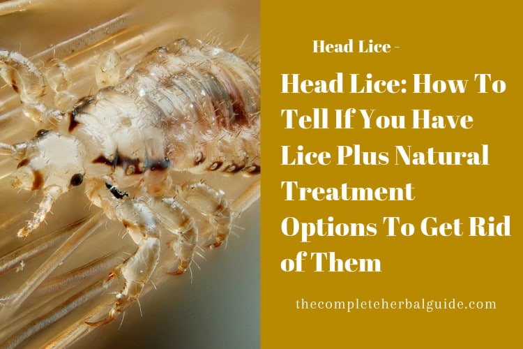 Head Lice: How To Tell If You Have Lice Plus Natural Treatment Options To Get Rid of Them