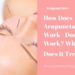 How Does Acupuncture Work - Does It Work? What Does It Treat?‎