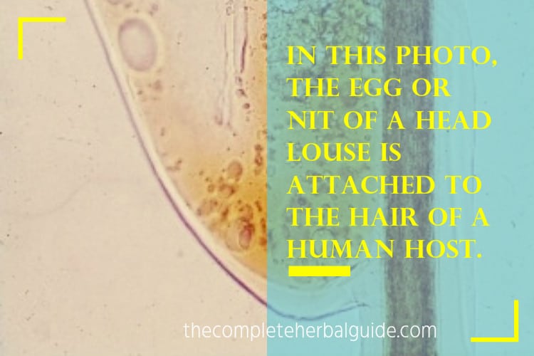 In this photo, the egg or nit of a head louse is attached to the hair of a human host.