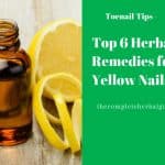 Top 6 Herbal Remedies for Yellow Nails