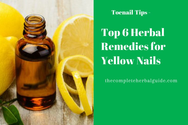 Top 6 Herbal Remedies for Yellow Nails