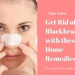 Get Rid of Blackheads with these 5 Home Remedies