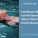 Can Herpes Be Cured Naturally? This is What You Need to Know
