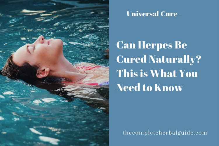 Can Herpes Be Cured Naturally? This is What You Need to Know