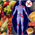 Diet-arthritis-patients