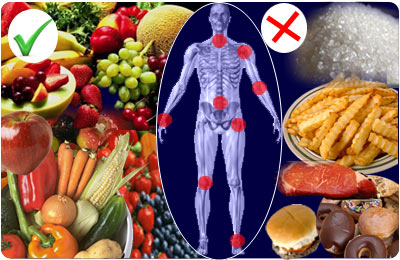 Rezultate imazhesh pÃ«r artritis best foods
