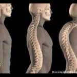 aging spine