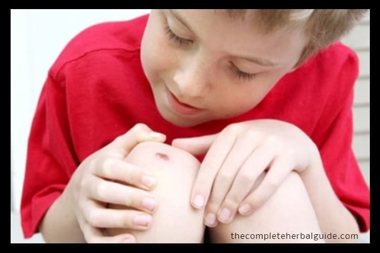 Tea Tree Oil for Infections and Cuts