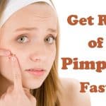 Home Remedies for How to Get Rid of Pimples Fast