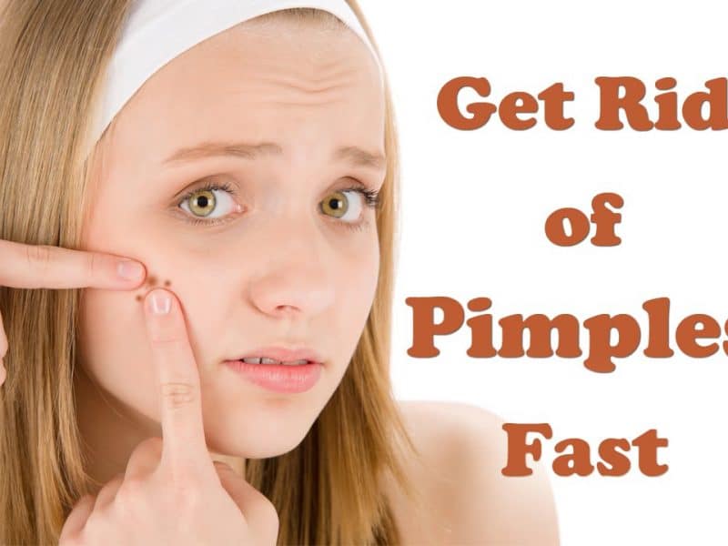 Home Remedies for How to Get Rid of Pimples Fast