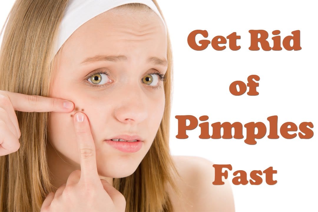 Home Remedies for How to Get Rid of Pimples Fast