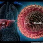 hepatitis virus