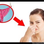 vaginal odor